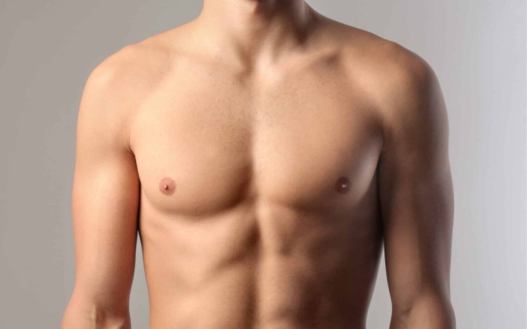 Gynecomastie en Turquie : guide complet et prix